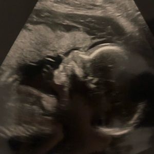 Meet your Posher, Allissa